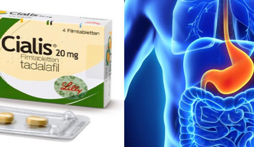 空腹吃犀利士會不會傷胃